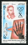 14444186-EGYPT-CIRCA-1995-stamp-printed-by-Egypt-shows-X-ray-of-hand-Wilhelm-Conrad-Rontgen-portrait-circa-19-Stock-Photo